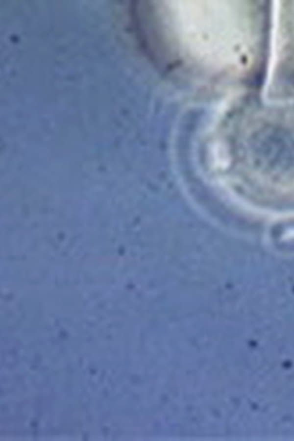 [Sperm and Egg Footage]