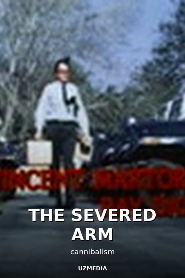 THE SEVERED ARM — Kino 