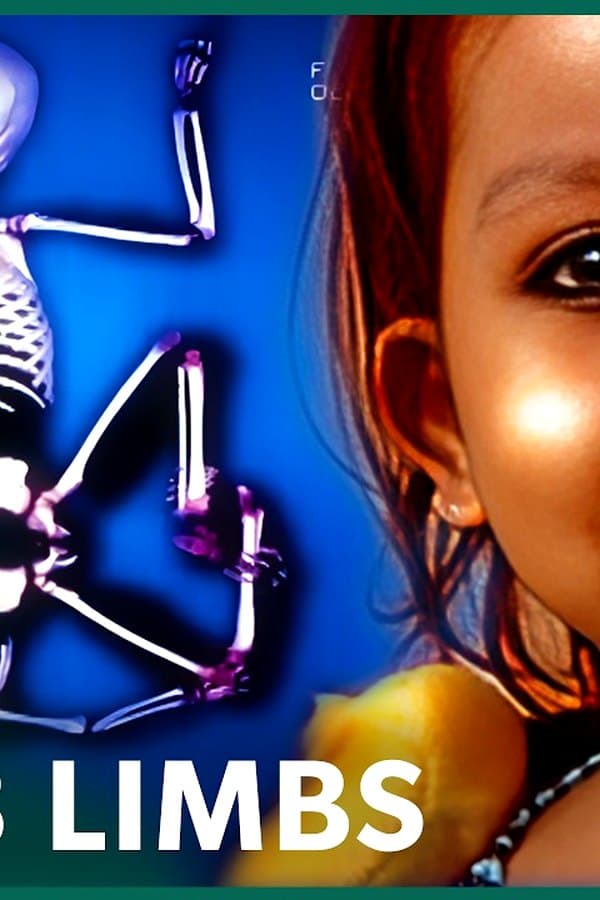 The Girl Born With 8 Limbs: Hindu Goddess Or Normal Little Girl?
