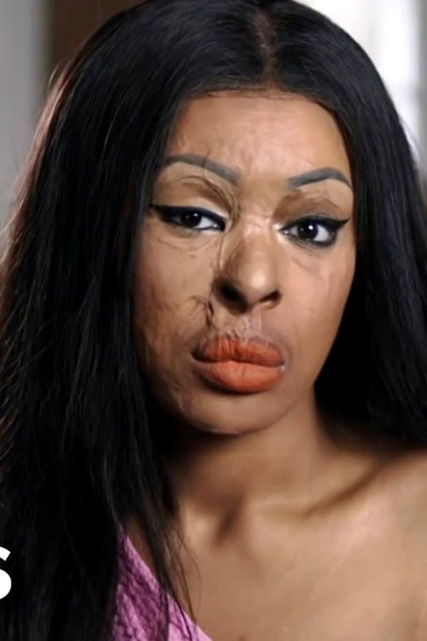 ACID ATTACK: My Story (Crime Documentary)