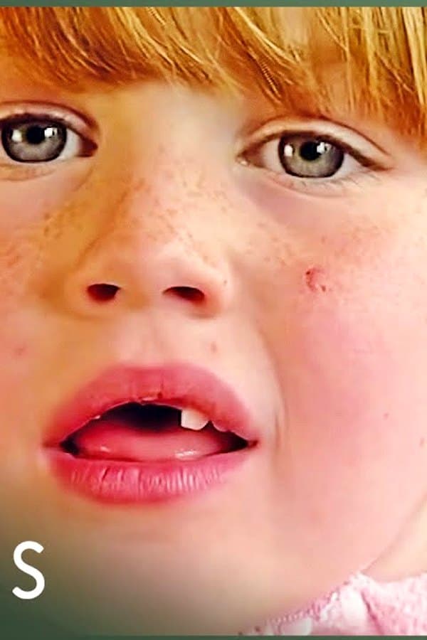 Children With Body Dysmorphia: Skinny Kids (Mental Health Documentary)
